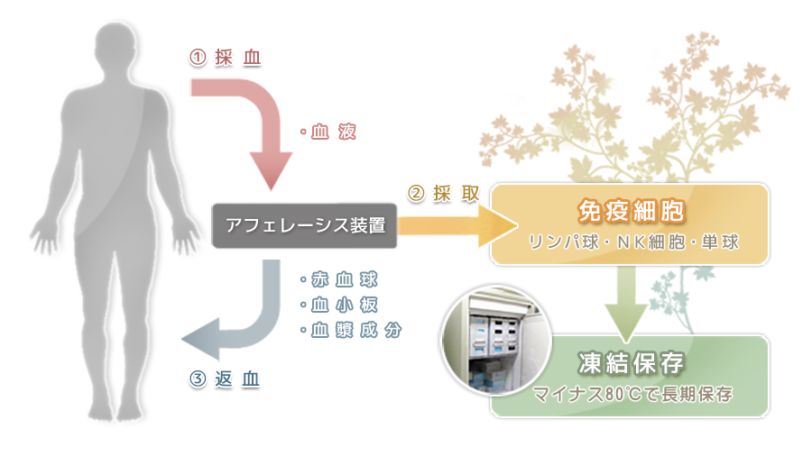 アフェレーシスの流れ