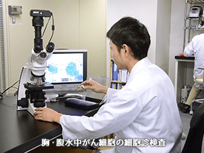 胸・腹水中がん細胞の細胞診検査
